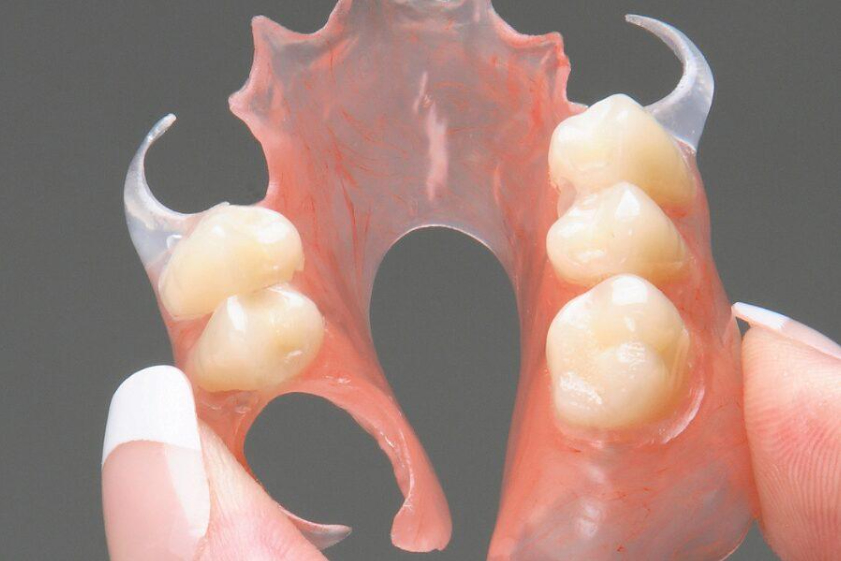 Flexible denture in Lahore