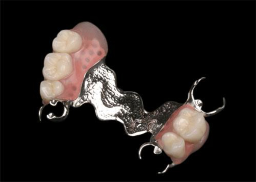 Cobalt chromium denture in Lahore