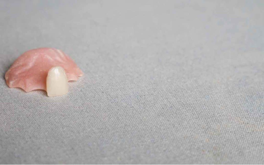 Upper front artificial tooth in Lahore