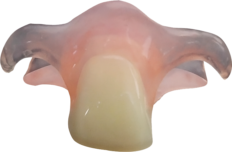 Front single artificial tooth in Lahore