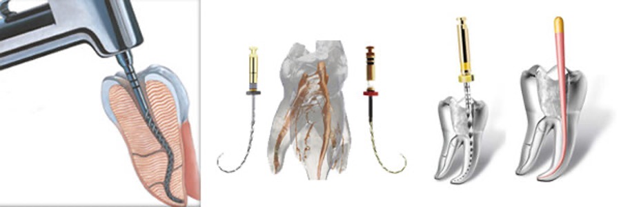 Rotary root canal instruments