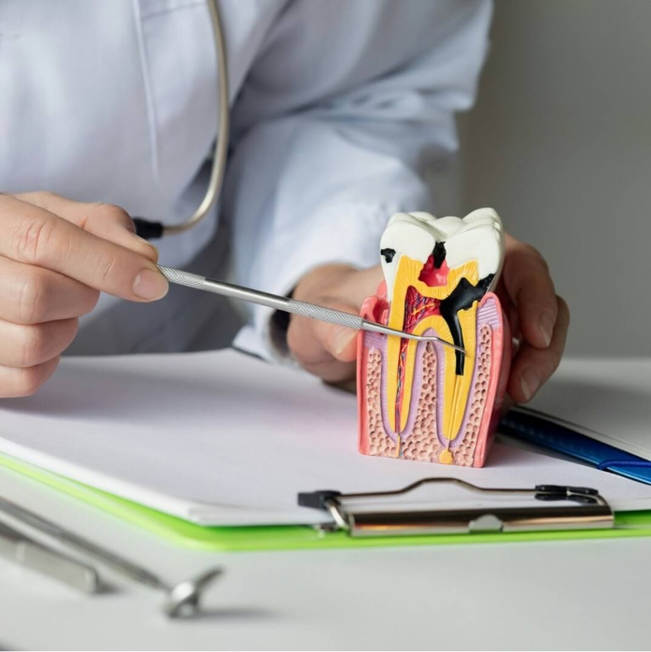 Root canal treatment in Lahore