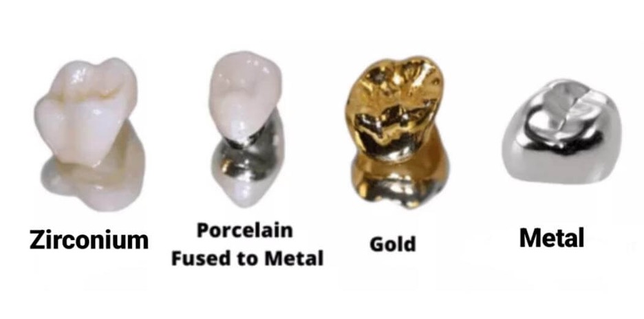 Types of crown in Lahore